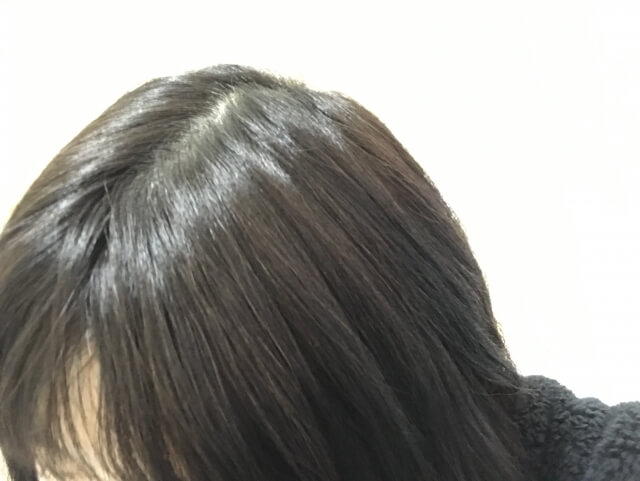 頭　髪の毛